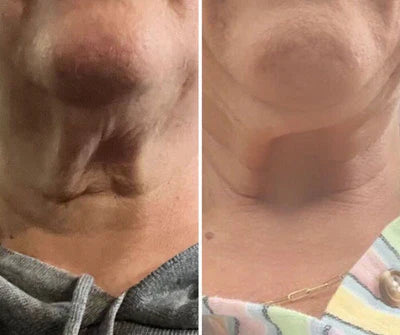 Before and after