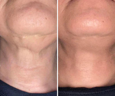 Before and after