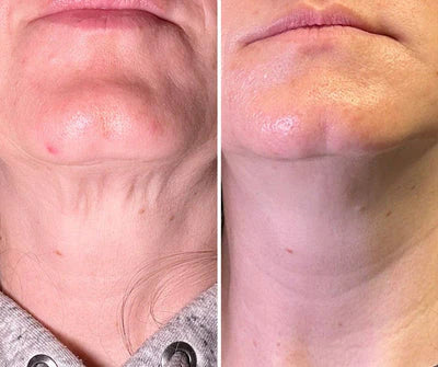 Before and after
